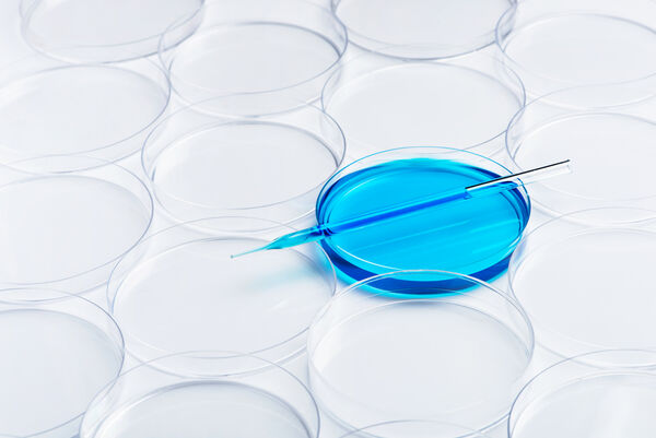 blue cell cultures in the laboratory in a petri dish